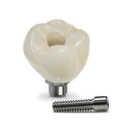 پروتز های استاتیک