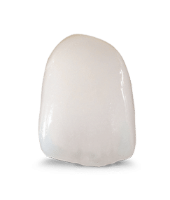 پروتز های استاتیک